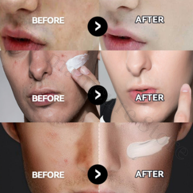 Before and after comparison of men's skin showing the coverage and smoothing effects of MANCODES hydrating BB cream.