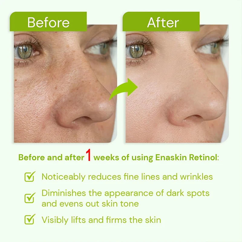Anti-Aging Wrinkle Removal Face Serum – Hyaluronic Acid & Niacinamide (30ml)
