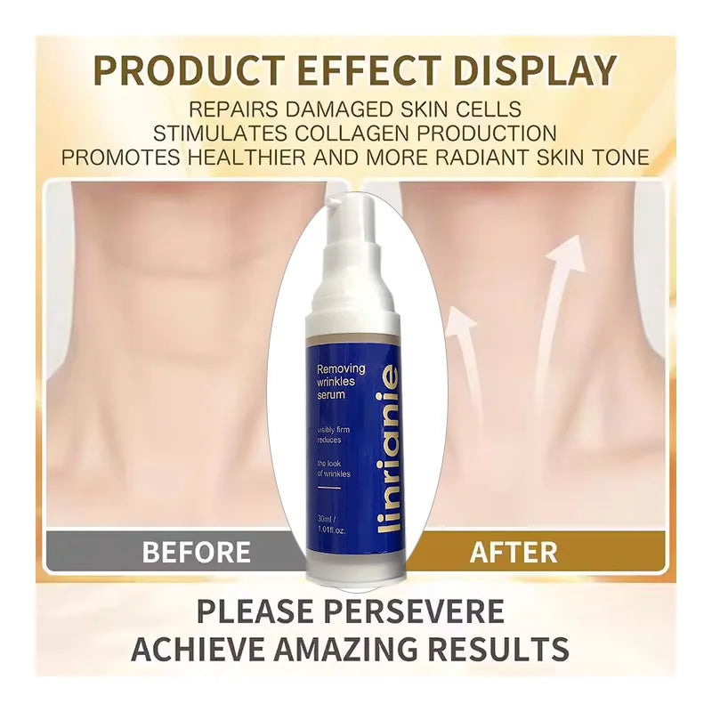 Anti-Aging Wrinkle Removal Face Serum – Hyaluronic Acid & Niacinamide (30ml)